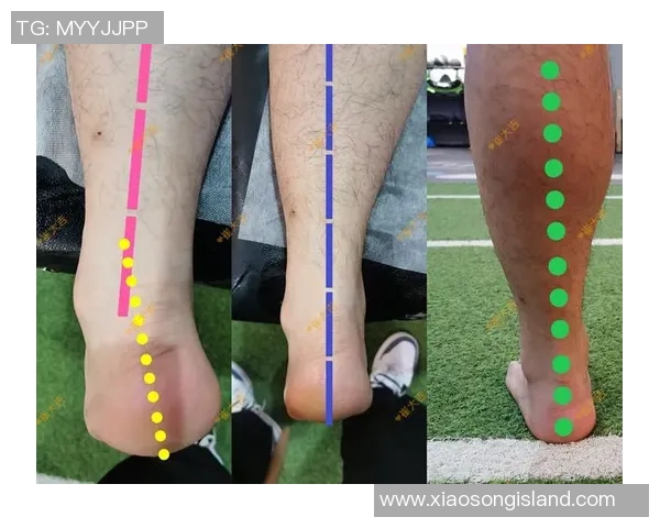 世界足球巨星O型腿最严重案例解析及其影响力深度分析